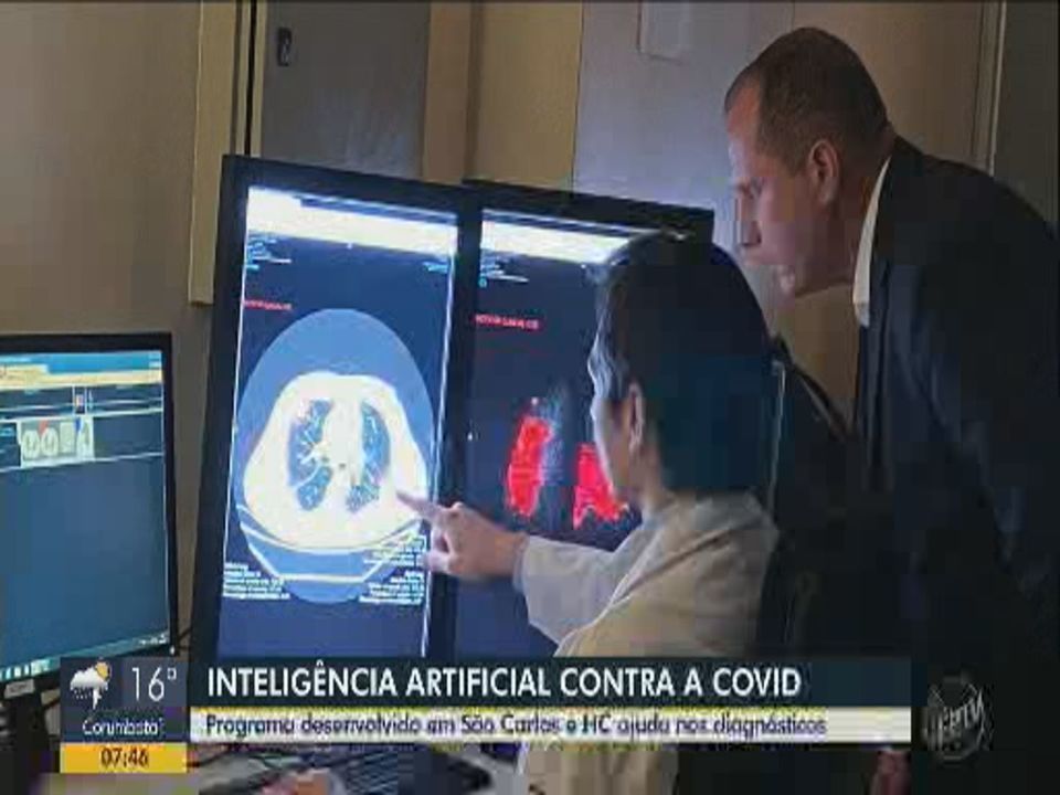 Programa desenvolvido em São Carlos ajuda a diagnosticar lesões da Covid nos pulmões