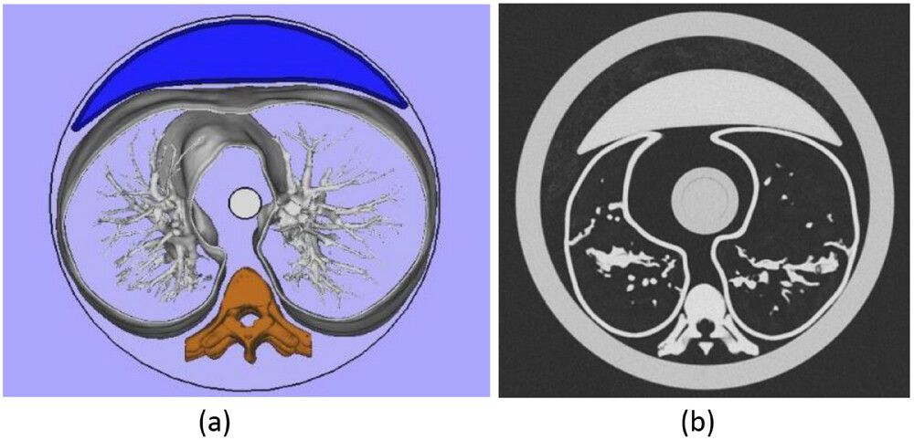 INRAD contribui em nova tecnologia capaz de otimizar exames de tomografia e reduzir exposição à radiação